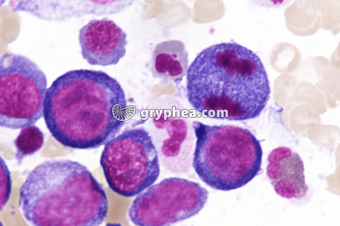 Moelle osseuse humaine cellules en mitose - anaphase x400 - gryphea.org